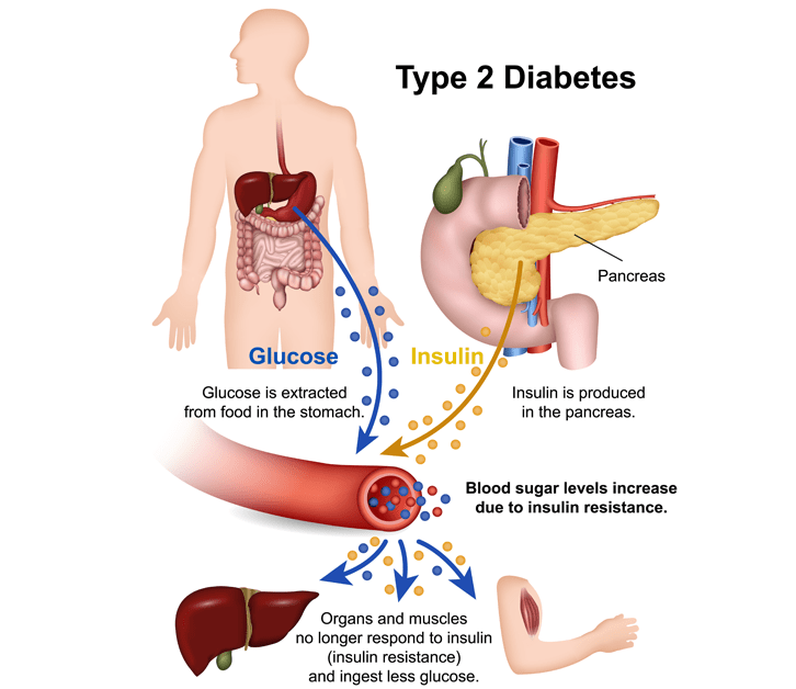 diabetes-guide